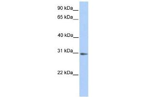 ABHD13 antibody used at 1 ug/ml to detect target protein. (ABHD13 抗体  (N-Term))