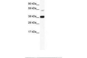 Image no. 1 for anti-V-Rel Reticuloendotheliosis Viral Oncogene Homolog B (RELB) (AA 358-407) antibody (ABIN202760) (RELB 抗体  (AA 358-407))