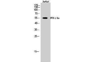 Western Blotting (WB) image for anti-PFK-2 LIV (C-Term) antibody (ABIN3180808) (PFK-2 LIV (C-Term) 抗体)