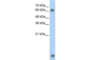 Western Blotting (WB) image for anti-Methyl-CpG Binding Domain Protein 1 (MBD1) antibody (ABIN2460355) (MBD1 抗体)