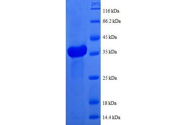 COX6B1 Protein (AA 1-86, full length) (GST tag)