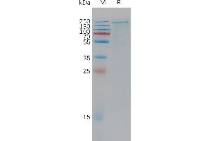 Human Protein, His Tag on SDS-PAGE under reducing condition. (LRP6 Protein (AA 20-1370) (His tag))