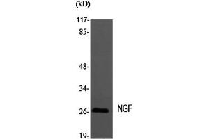 Western Blot analysis of MEF1 cells using NGF Polyclonal Antibody at dilution of 1:2000. (Nerve Growth Factor 抗体)