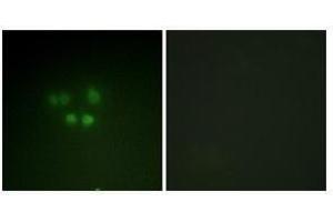 Immunofluorescence analysis of A549 cells using Nibrin antibody . (Nibrin 抗体)