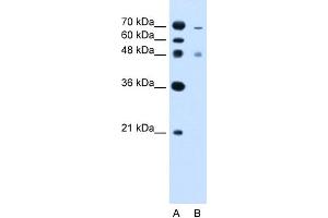 WB Suggested Anti-ZFYVE27 Antibody Titration:  2. (ZFYVE27 抗体  (C-Term))