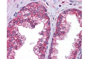 STAT6 antibody was used for immunohistochemistry at a concentration of 4-8 ug/ml. (STAT6 抗体  (C-Term))