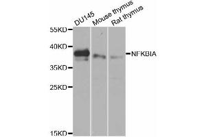 Western blot analysis of extracts of various cell lines, using NFKBIA antibody (ABIN5970533) at 1/1000 dilution. (NFKBIA 抗体)