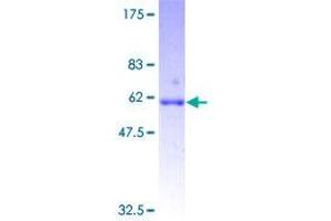 Image no. 1 for Growth Differentiation Factor 10 (GDF10) (AA 1-288) protein (GST tag) (ABIN1354958) (GDF10 Protein (AA 1-288) (GST tag))