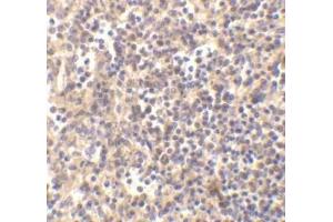 Immunohistochemical staining ofDNaseII in human spleen with DNase II antibody at 5μg/ml. (DNASE2 抗体)