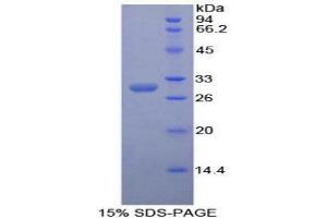 SDS-PAGE analysis of Mouse Contactin 3 Protein. (CNTN3 蛋白)