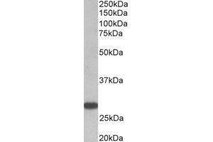 Western Blotting (WB) image for anti-Thyroid Stimulating Hormone Receptor (TSHR) (Internal Region) antibody (ABIN2464943) (TSH receptor 抗体  (Internal Region))