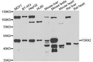 Western blot analysis of extracts of various cell lines, using P2RX2 antibody. (P2RX2 抗体)