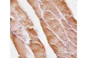 Immunohistochemical analysis of paraffin-embedded mouse skeletal muscle using Musk antibody at 1:25 dilution. (MUSK 抗体)