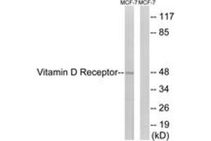 Western blot analysis of extracts from MCF-7 cells, using Vitamin D Receptor (Ab-208) Antibody. (Vitamin D Receptor 抗体  (AA 181-230))