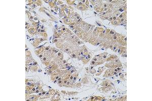 Immunohistochemistry of paraffin-embedded human stomach using TRMT2A antibody. (TRMT2A 抗体)