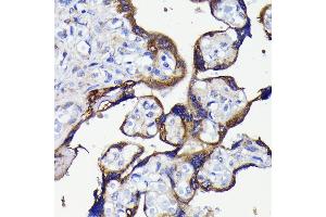 Immunohistochemistry of paraffin-embedded human placenta using  antibody (ABIN7265710) at dilution of 1:100 (40x lens). (ATG5 抗体)