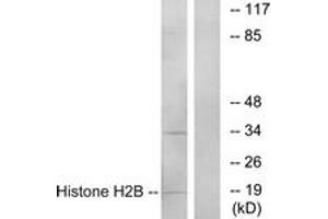 Western blot analysis of extracts from A549 cells, using Histone H2B Antibody. (Histone H2B 抗体  (AA 1-50))