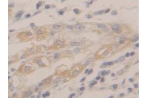 DAB staining on IHC-P; Samples: Human Stomach Tissue (Peroxiredoxin 2 抗体  (AA 6-164))