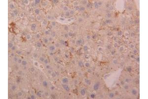DAB staining on IHC-P; Samples: Human Liver Tissue (Cathepsin D 抗体  (AA 23-161))
