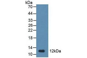 Detection of TFF1 in Rat Stomach Tissue using Polyclonal Antibody to Trefoil Factor 1 (TFF1) (TFF1 抗体  (AA 1-81))