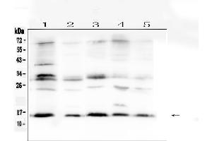 Western blot analysis of ISG15/Ucrp using anti-ISG15/Ucrp antibody . (ISG15 抗体  (AA 2-155))