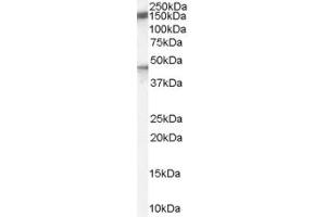 Western Blotting (WB) image for anti-Chromosome 11 Open Reading Frame 70 (C11ORF70) (C-Term) antibody (ABIN2790946) (C11ORF70 抗体  (C-Term))