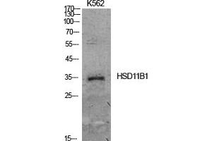 Western Blot analysis of K562 cells using 11β-HSD1 Polyclonal Antibody. (HSD11B1 抗体  (N-Term))