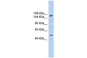 SHPRH antibody used at 1 ug/ml to detect target protein. (SHPRH 抗体  (N-Term))