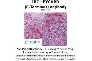 Image no. 2 for anti-PYD and CARD Domain Containing (PYCARD) (C-Term) antibody (ABIN1738638) (PYCARD 抗体  (C-Term))