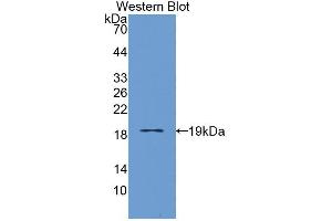 Western blot analysis of the recombinant protein. (IL3RA 抗体  (AA 19-157))