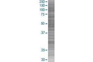 TNFSF10 transfected lysate. (TNFSF10 293T Cell Transient Overexpression Lysate(Denatured))