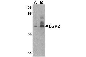 Image no. 1 for anti-DEXH (Asp-Glu-X-His) Box Polypeptide 58 (DHX58) (C-Term) antibody (ABIN1492185) (DHX58 抗体  (C-Term))