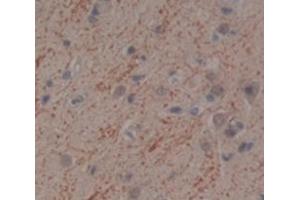 IHC-P analysis of Human Tissue, with DAB staining. (IFNA10 抗体  (AA 24-189))