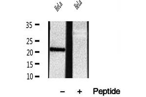 Western blot analysis of extracts of HeLa cells, using REEP5 antibody. (REEP5 抗体  (N-Term))