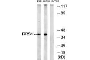 Western blot analysis of extracts from HuvEc/293 cells, using RRS1 Antibody. (RRS1 抗体  (AA 254-303))