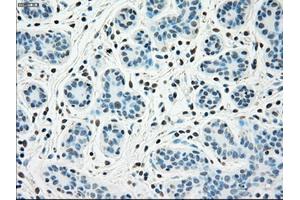 Immunohistochemical staining of paraffin-embedded breast tissue using anti-SSB mouse monoclonal antibody. (SSB 抗体)