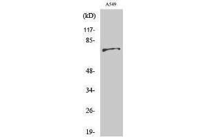 Western Blotting (WB) image for anti-BMX Non-Receptor Tyrosine Kinase (BMX) (Ser182) antibody (ABIN3174045) (BMX 抗体  (Ser182))