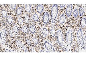 Human tonsil: immunohistochemical staining for CD56. (CD56 抗体  (Extracellular Domain))