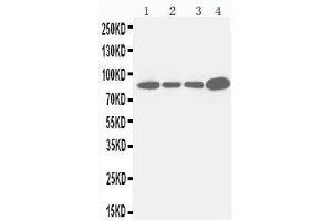 Anti-Integrin beta 3 antibody, Western blotting Lane 1: JURKAT Cell Lysate Lane 2: RAJI Cell Lysate Lane 3: CEM Cell Lysate Lane 4: COLO320 Cell Lysate (Integrin beta 3 抗体  (C-Term))