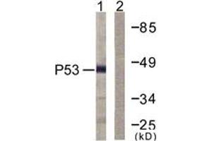 Western blot analysis of extracts from COS7 cells, treated with TSA 400nM 24h, using p53 (Ab-379) Antibody. (p53 抗体  (AA 336-385))