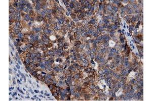 Immunohistochemical staining of paraffin-embedded Human colon tissue using anti-AK5 mouse monoclonal antibody. (Adenylate Kinase 5 抗体)