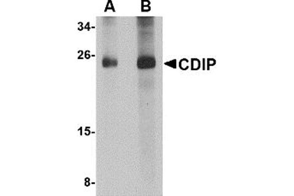 CDIP1 抗体  (Middle Region 1)