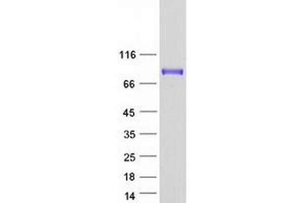 HIRIP3 Protein (Myc-DYKDDDDK Tag)