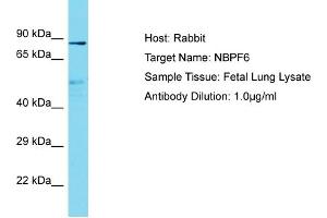 Host: Rabbit Target Name: NBPF6 Sample Type: Fetal Lung lysates Antibody Dilution: 1. (NBPF6 抗体  (C-Term))