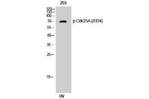 Western Blotting (WB) image for anti-Cell Division Cycle 25 Homolog A (S. Pombe) (CDC25A) (pSer124) antibody (ABIN3182248) (CDC25A 抗体  (pSer124))