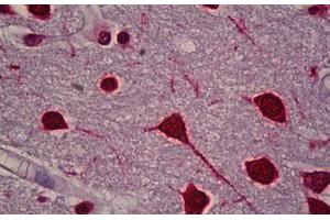 Anti-FOS / c-FOS antibody IHC staining of human brain, cortex. (c-FOS 抗体)