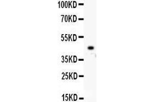 Western Blotting (WB) image for anti-Homeobox A10 (HOXA10) (AA 57-340) antibody (ABIN3042453) (HOXA10 抗体  (AA 57-340))