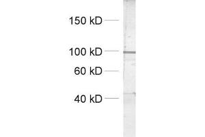 dilution: 1 : 1000, sample: crude synaptosomal fraction of rat brain (P2) (Dynamin 1, 2, 3 (AA 2-17) 抗体)