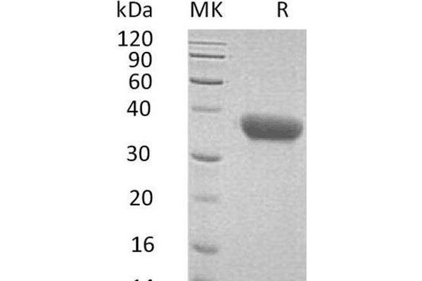 CXCL16 Protein (His tag)