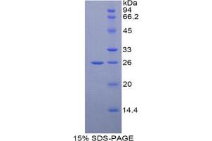 SDS-PAGE analysis of Human GRIP1 Protein. (GRIP1 蛋白)